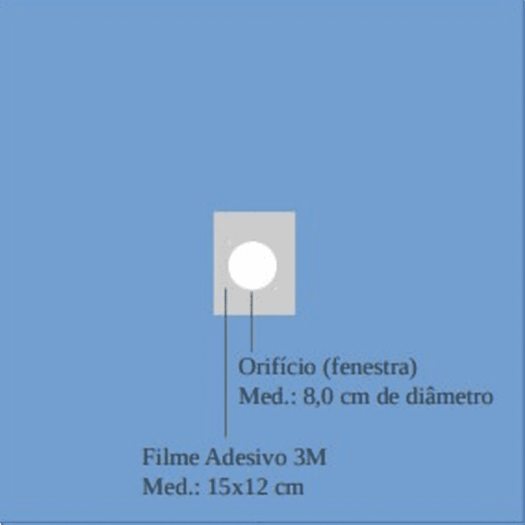 Campo Cirúrgico Fenestrado c/ Adesivo Ocular - Estéril